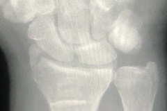 WardXray